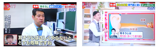 テレビ朝日 羽鳥慎一モーニングショー